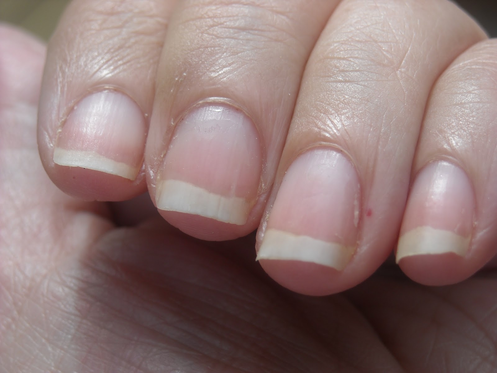 Normal Color of Nail Bed - wide 8